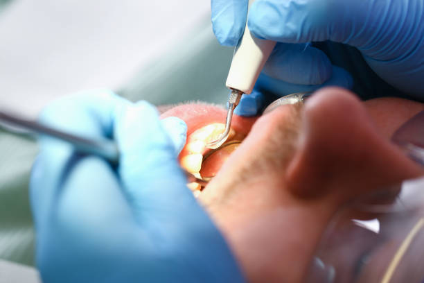 Best Broken or Cracked Tooth Emergency Dentist in Justice, OK