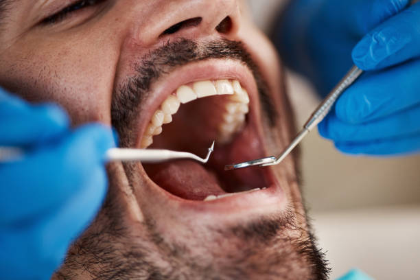Best Broken or Cracked Tooth Emergency Dentist in Justice, OK