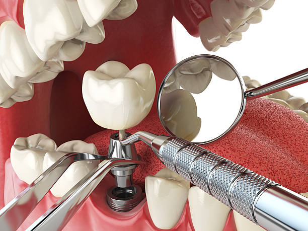 Best Emergency Dental Care for Abscessed Tooth in Justice, OK