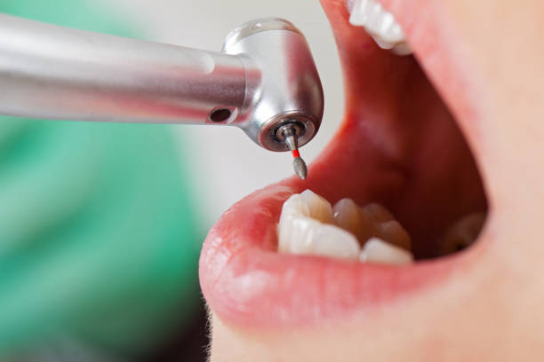 Best Emergency Dental Extractions in Justice, OK